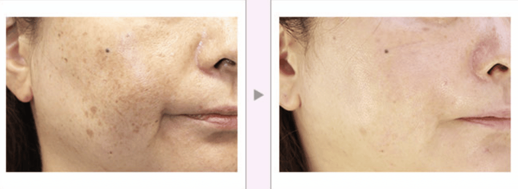 品川美容外科の症例画像