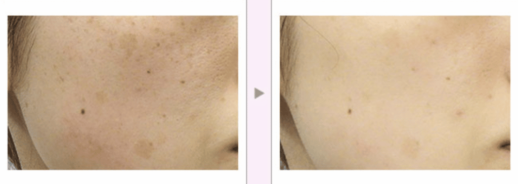 品川美容外科の症例画像